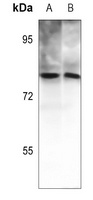 PKC theta (Phospho-T538) Antibody
