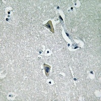 PKC theta (Phospho-T538) Antibody