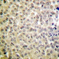 MSK1 (Phospho-S360) Antibody