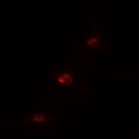 MSK1 (Phospho-S360) Antibody