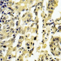 EPG5 Rabbit Polyclonal Antibody