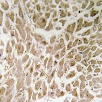IRX1 Rabbit Polyclonal Antibody
