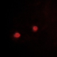 IRX1 Rabbit Polyclonal Antibody
