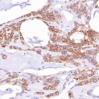 Goat Mouse/Rabbit IgG (H&L)-HRP Polymer (Ready to use) Antibody