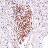 Goat Mouse/Rabbit IgG (H&L)-HRP Polymer (Ready to use) Antibody