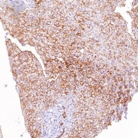 Goat Rabbit IgG (H&L)-HRP Polymer (Ready to use) Antibody