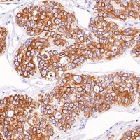 Goat Mouse/Rabbit IgG (H&L)-HRP Polymer Antibody