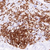 Goat Mouse IgG (H&L)-HRP Polymer Antibody