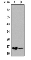 FABP1 Rabbit Polyclonal Antibody