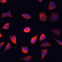 FABP1 Rabbit Polyclonal Antibody