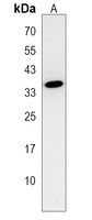 clvs2 Rabbit Polyclonal Antibody