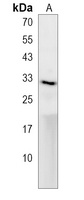 ak2 Rabbit Polyclonal Antibody