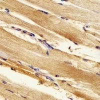 ak2 Rabbit Polyclonal Antibody