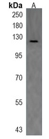 stil Rabbit Polyclonal Antibody