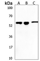 KLHL20 Antibody