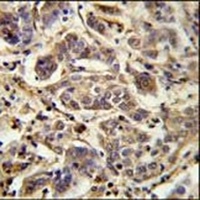 AAGAB Rabbit Polyclonal Antibody