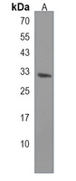 CRLS1 Rabbit Polyclonal Antibody
