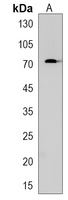 HAUS5 Rabbit Polyclonal Antibody