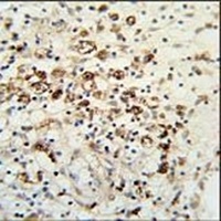 HAUS5 Rabbit Polyclonal Antibody
