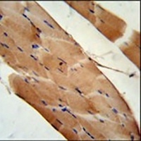 CNOT6L Antibody