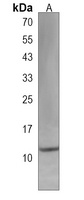 IFT20 Rabbit Polyclonal Antibody