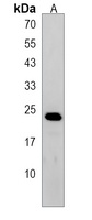 PTPLB Rabbit Polyclonal Antibody