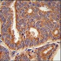 PTPLB Rabbit Polyclonal Antibody