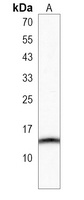 SPRN Rabbit Polyclonal Antibody