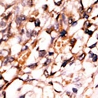 PRAK (Phospho-S93) Antibody