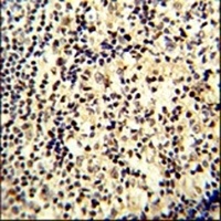 SNRPD1 Rabbit Polyclonal Antibody