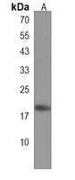 SNRPC Rabbit Polyclonal Antibody