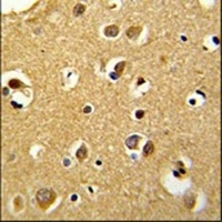 SNRPC Rabbit Polyclonal Antibody