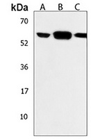 UGP2 Rabbit Polyclonal Antibody