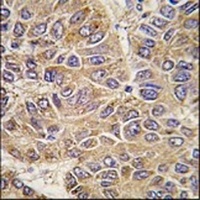 UGP2 Rabbit Polyclonal Antibody