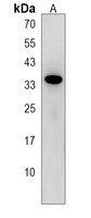 SULT4A1 Rabbit Polyclonal Antibody