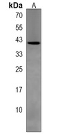 TPST2 Rabbit Polyclonal Antibody