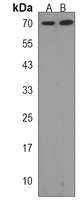 GGA1 Rabbit Polyclonal Antibody