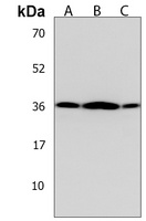 OR5V1 Rabbit Polyclonal Antibody