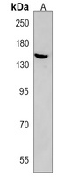 SEC24B Rabbit Polyclonal Antibody
