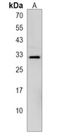 DLX1 Rabbit Polyclonal Antibody