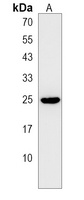 MIF4GD Rabbit Polyclonal Antibody