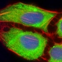 MIF4GD Rabbit Polyclonal Antibody