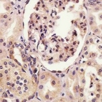 SYNE2 Rabbit Polyclonal Antibody