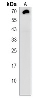 TMEM106B Antibody