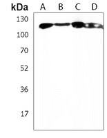 INTS3 Rabbit Polyclonal Antibody