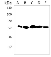 IRX4 Rabbit Polyclonal Antibody