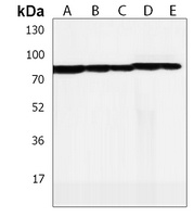 LRCH4 Rabbit Polyclonal Antibody