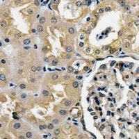 COPS7B Rabbit Polyclonal Antibody