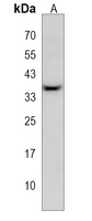 GLT6D1 Rabbit Polyclonal Antibody