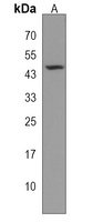 PNPLA5 Rabbit Polyclonal Antibody